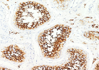 Anti-ACE2 Monoclonal Recombinant Antibody