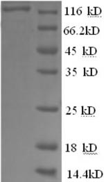 Glycogen phosphorylase, liver form (PYGL),partial, human, recombinant