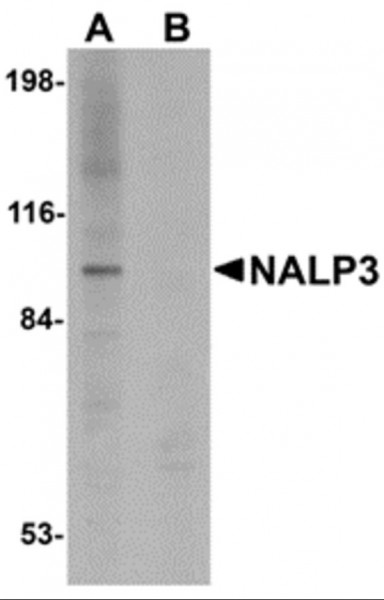 Anti-NALP3 / Cryopyrin