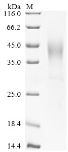 Glucose-6-phosphatase (G6PC), partial, human, recombinant