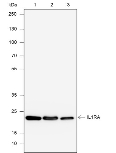 Anti-Recombinant IL-1RA, clone A628