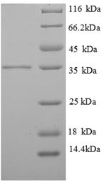 Tropomyosin beta chain (TPM2), partial, human, recombinant