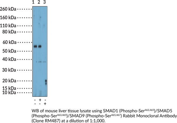 Anti-SMAD1 (Phospho-Ser463,465)/SMAD5 (Phospho-Ser463,465)/SMAD9