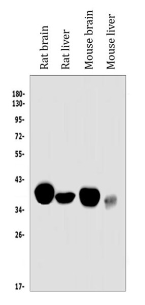 Anti-NADH2 / MT-ND2