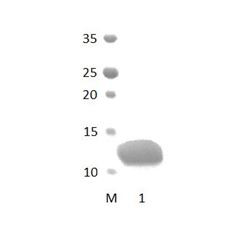 NHERF_1 PDZ Domain