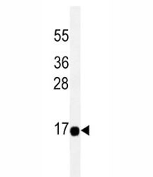 Anti-THEM2, clone 169CT7.1.3