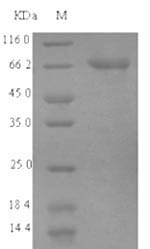 Acyl-CoA synthetase family member 2, mitochondrial (ACSF2), human, recombinant