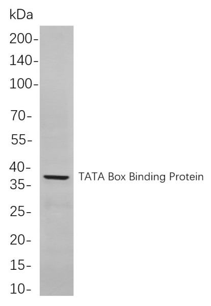 Anti-Recombinant TATA Box Binding Protein, clone 7F14