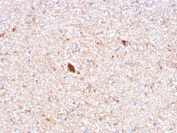 Anti-Serum Amyloid P, clone APCS/3240