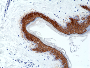 Anti-Cytokeratin 10 (human), Rabbit Monoclonal (RM386)