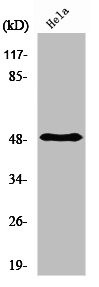 Anti-PDK1