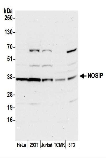 Anti-NOSIP
