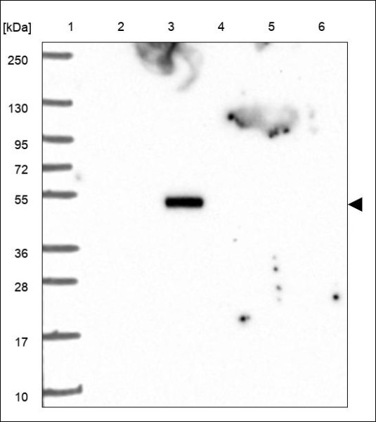 Anti-TFDP3