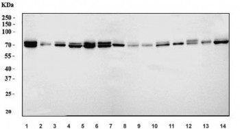 Anti-FACL4/ACSL4
