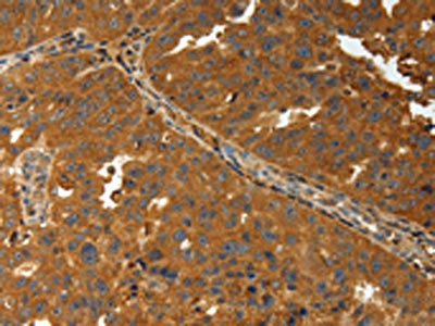 Anti-AMD1