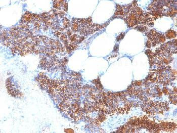 Anti-Parathyroid Hormone (PTH) (N-Terminal) Recombinant Rabbit Monoclonal Antibody (clone:PTH/2295R)