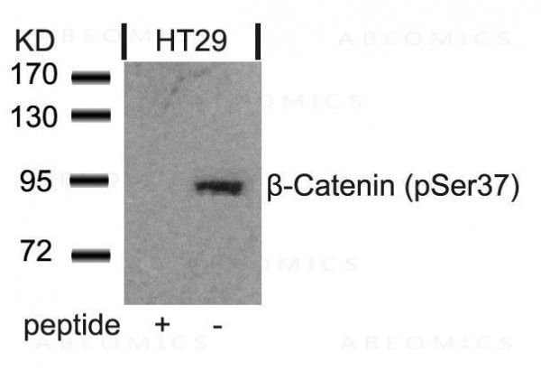 Anti-phospho-beta-Catenin (Ser37)