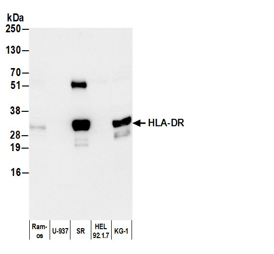 Anti-Mouse IgG2b, HRP conjugated