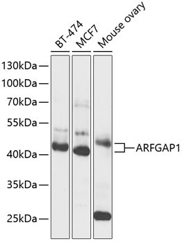 Anti-ARFGAP1