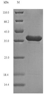 Fibroblast growth factor 10 (FGF10), partial, recombinant human