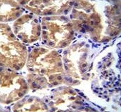 Anti-TRPM6