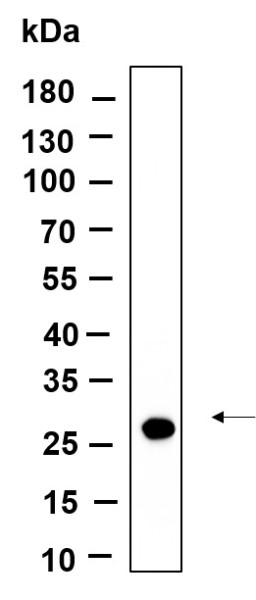 Anti-Recombinant CTRP2, clone 3G5