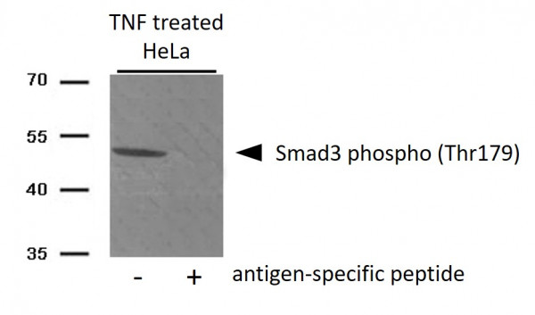 Anti-phospho-Smad3 (Thr179)