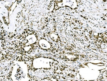 Anti-GRHL2 / Grainyhead-like protein 2 homolog