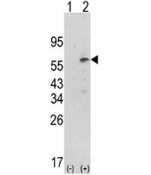 Anti-PDK1
