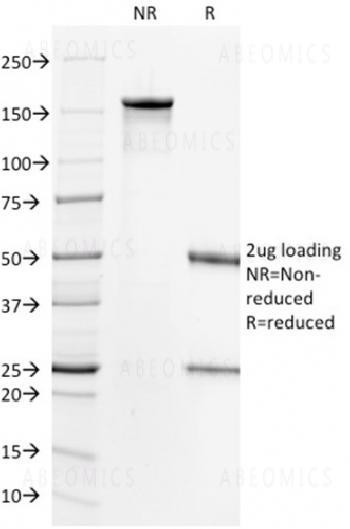 Anti-HER-2 / c-erbB-2 / neu / CD340 Monoclonal Antibody (Clone: HRB2/718)
