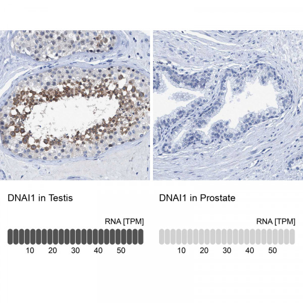 Anti-DNAI1