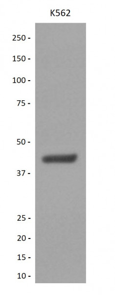 Anti-Bmi1