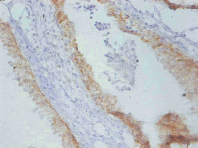 Anti-Timp1 Monoclonal, clone 4A2B1