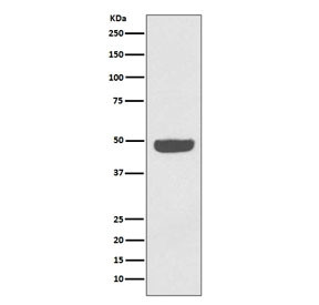 Anti-NSE / Neuron Specific Enolase, clone FBI-5