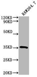 Anti-Sftpa1