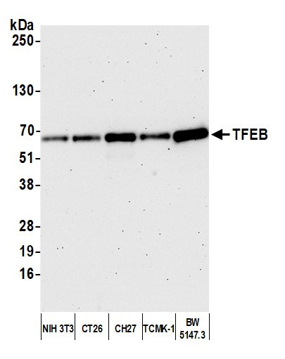 Anti-TFEB