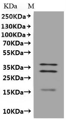 Metalloreductase STEAP1 (STEAP1)-VLPs, recombinant human