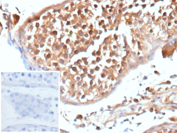 Anti-APC / Adenomatous polyposis coli, clone rEMM43