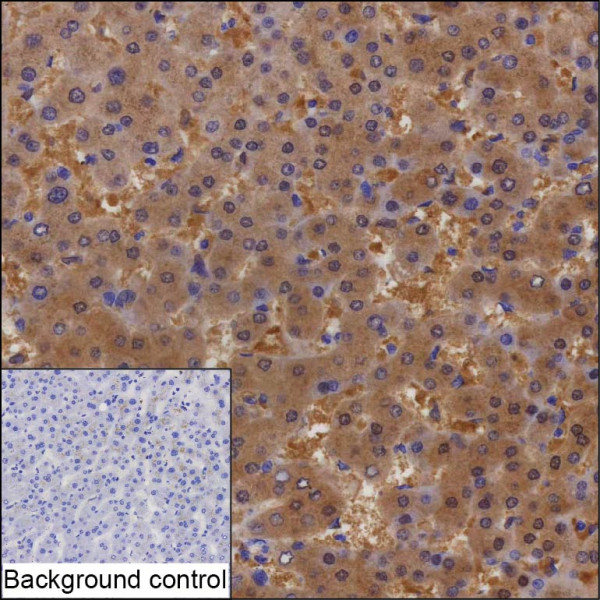 Anti-SULT1A1