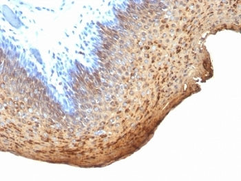 Anti-Cytokeratin 10 + 13, clone DE-K13