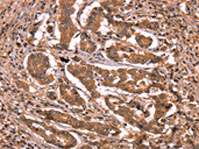 Anti-BCL6