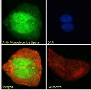 Anti-Monoglyceride lipase / MGLL