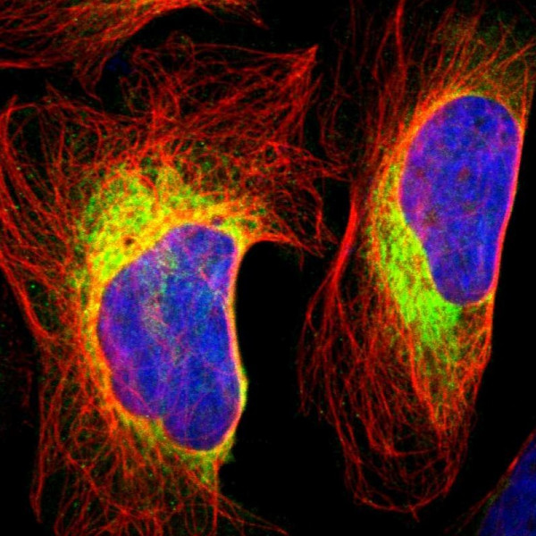 Anti-RRBP1