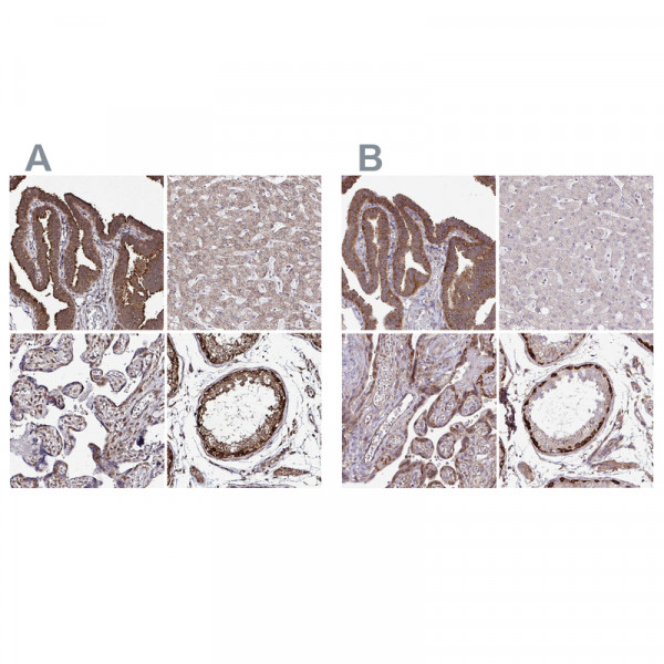 Anti-FMR1