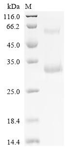 Gamma-interferon-inducible lysosomal thiol reductase (IFI30), partial, human, recombinant