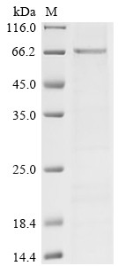 SET and MYND domain-containing protein 3 (SMYD3), human, recombinant