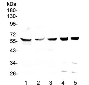 Anti-TCP1 eta / CCT7