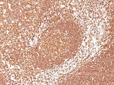 Anti-CD45 / LCA(2B11 + PD7/26), Biotin conjugate, 0.1mg/mL