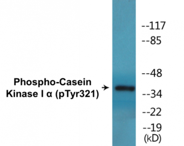 Casein Kinase I alpha (Phospho-Tyr321) Colorimetric Cell-Based ELISA Kit