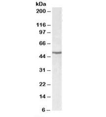 Anti-EEF1A2